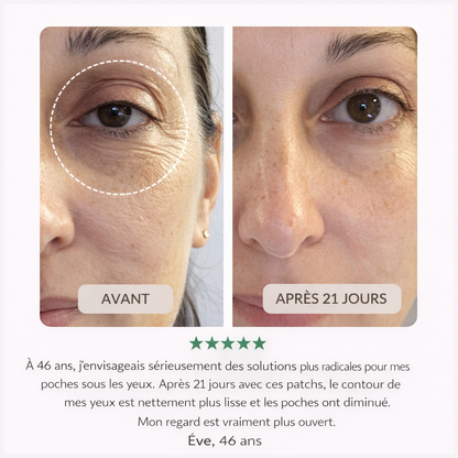 Patch Yeux 360° : agit sur paupières & cernes