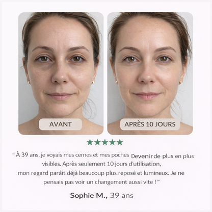 Patch Yeux 360° : agit sur paupières & cernes