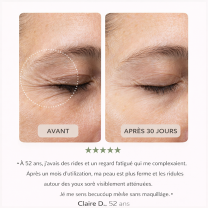 Patch Yeux 360° : agit sur paupières & cernes